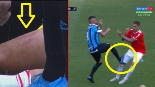 Grêmio