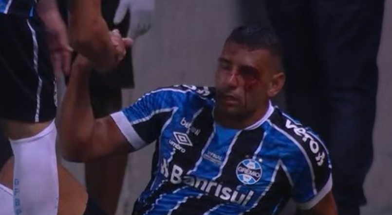 Luan "abre" rosto de Diego Souza, ganha apoio de Felipe Melo e dá explicações nas redes sociais Diego Souza