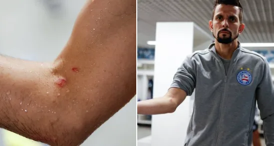 Bahia solta nota oficial e publica foto do braço do goleiro após lance do pênalti